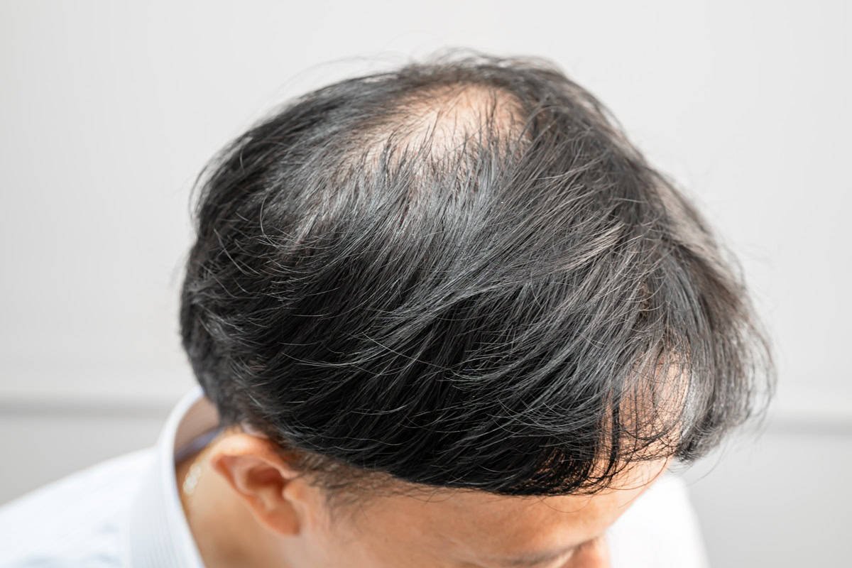 Scalp Therapy and Hair Care Treatment